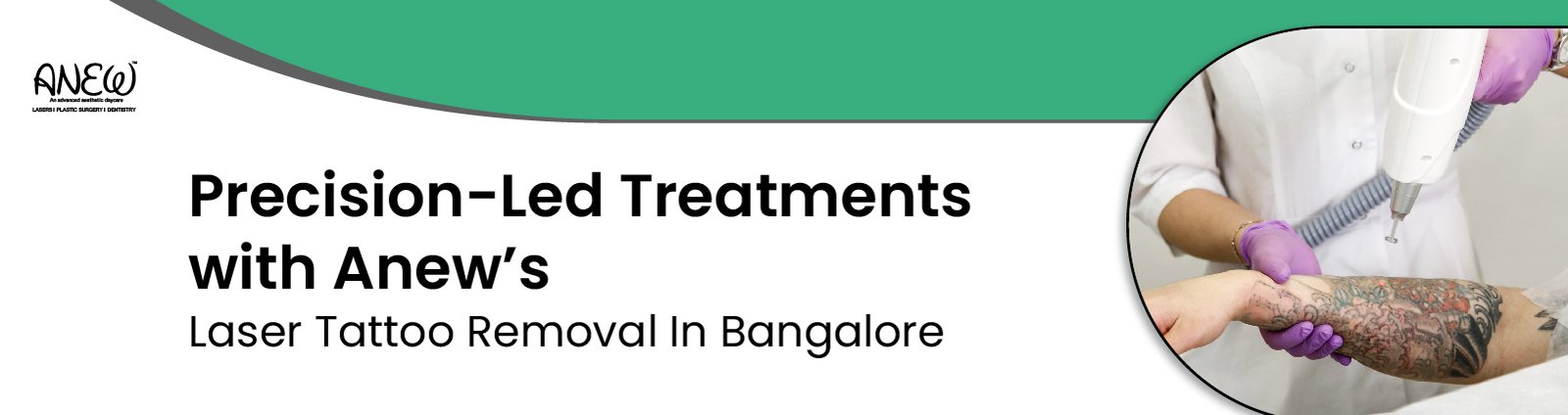  laser tattoo removal in bangalore